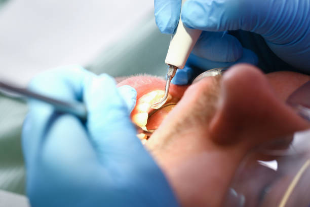 Best Emergency Gum Treatment in Spring Hill, FL