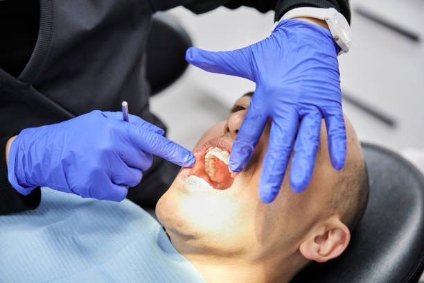 Best Emergency Treatment for Dental Infections or Abscesses in Spring Hill, FL
